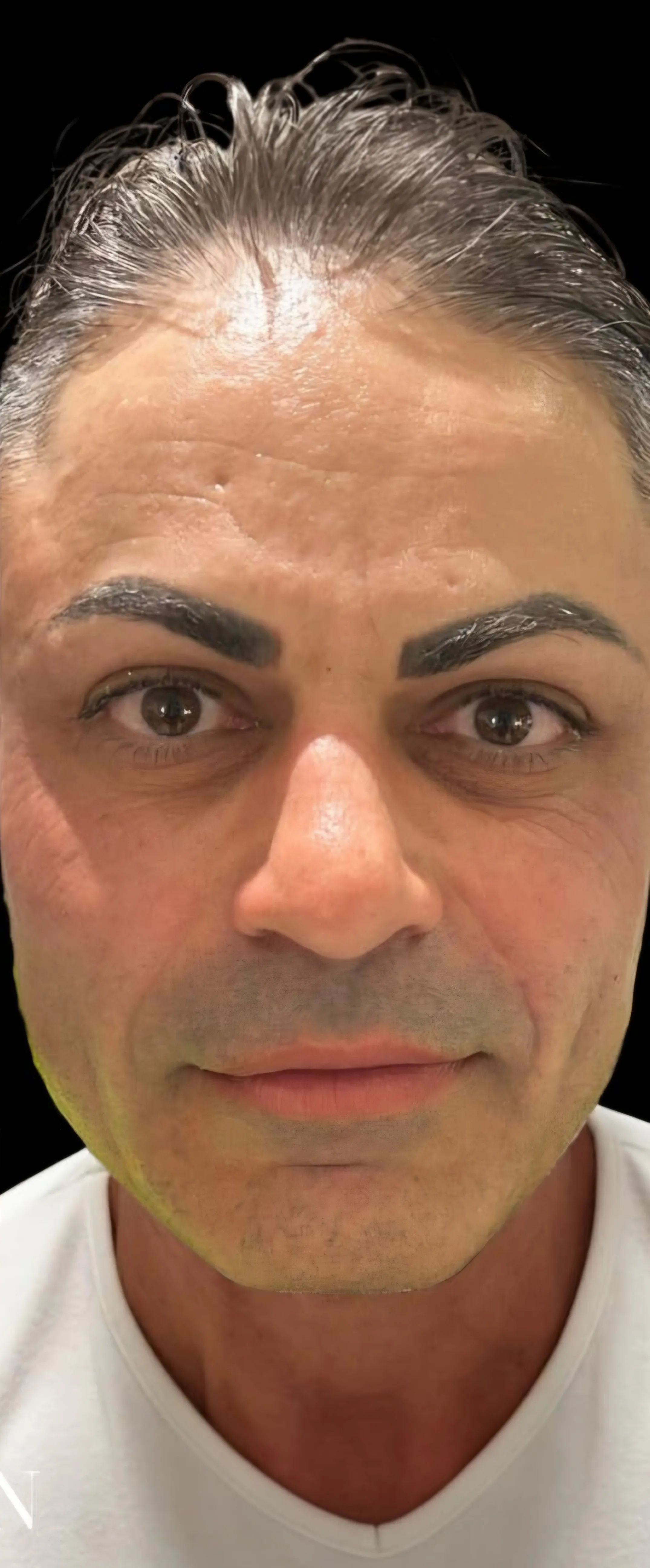 Lo stesso volto dopo il trattamento viso