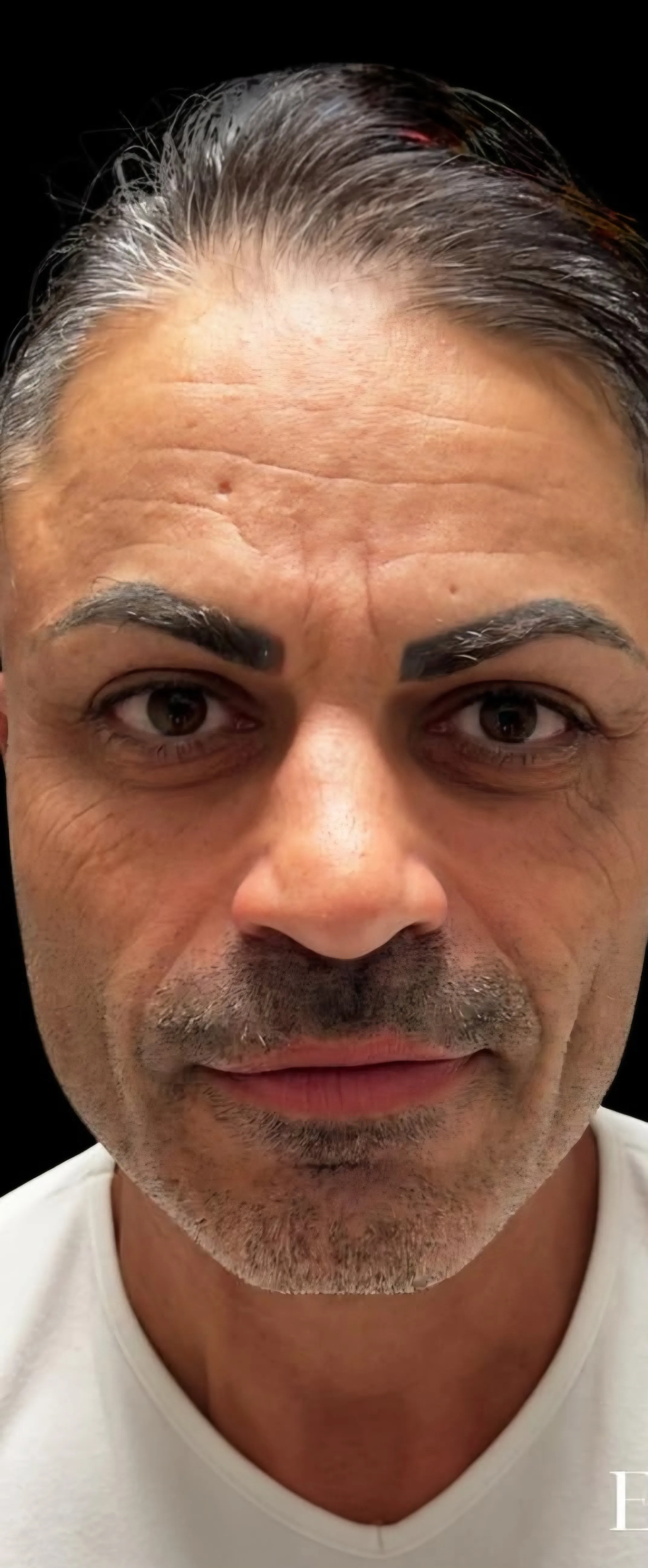 Volto maschile visto di fronte prima del trattamento viso